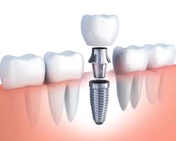 AISHA DENTAL CARE WANDOOR