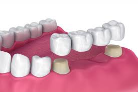 AISHA DENTAL CARE WANDOOR