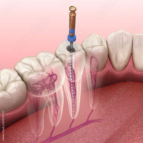 AISHA DENTAL CARE WANDOOR